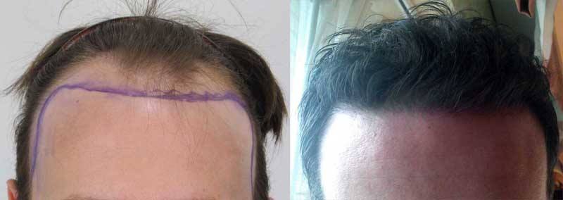 argan oil to regrow hair